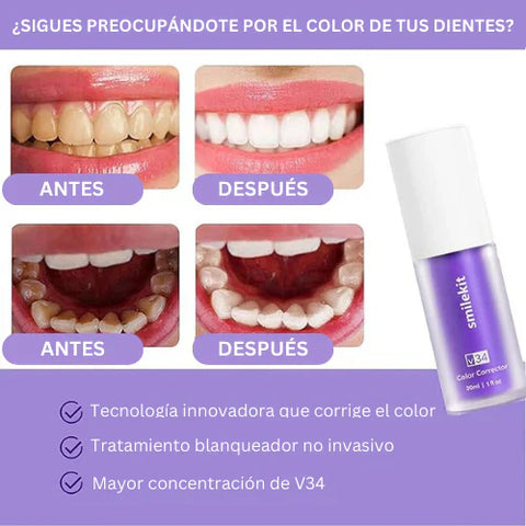 Crema Blanqueadora Dental V34 – ¡Sonríe sin manchas desde el primer uso! 😁
