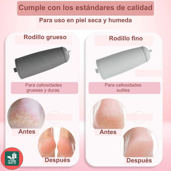 Removedor Eléctrico de callos-Profesional